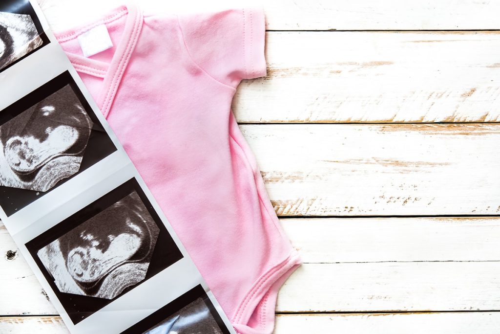 المرض النفسي أثناء الحمل- A baby's ultrasound on a white background with high resolution and courageously clear image.